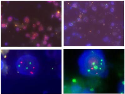 Frontiers Evaluation Of The Diagnostic Efficiency Of Voided Urine